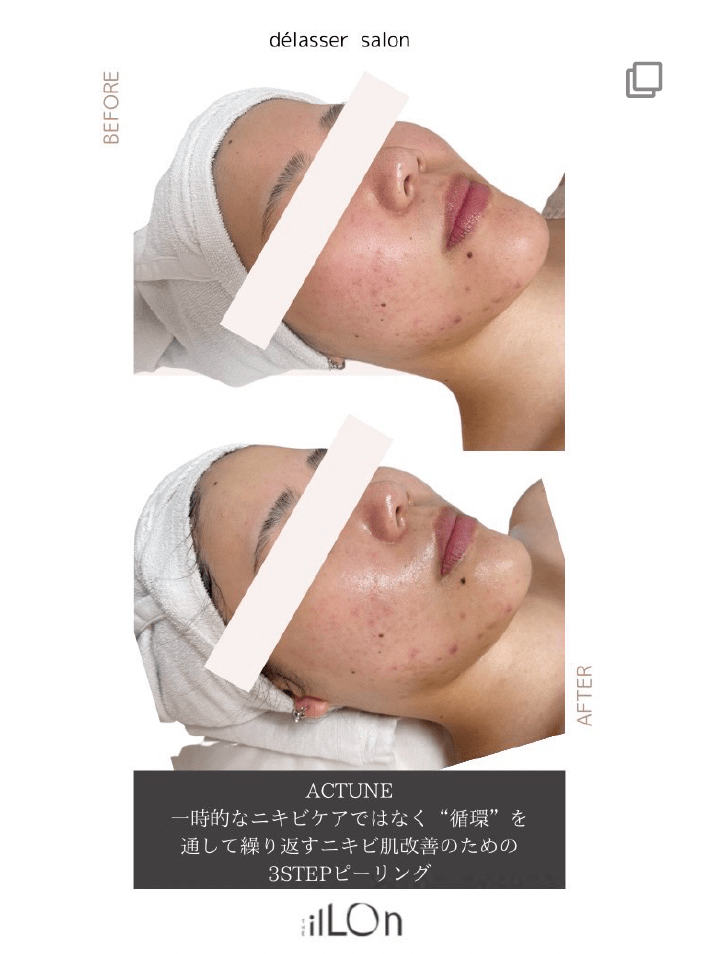 delasser salon GINZA FUJIEDA